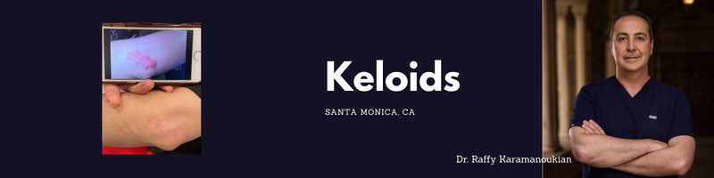 plastic surgery scar treatment in los angeles, beverly hills