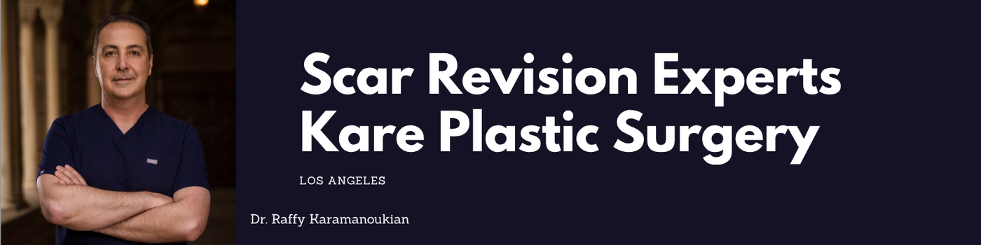 Scar revision doctor in los angeles with Dr. Raffy Karamanoukian