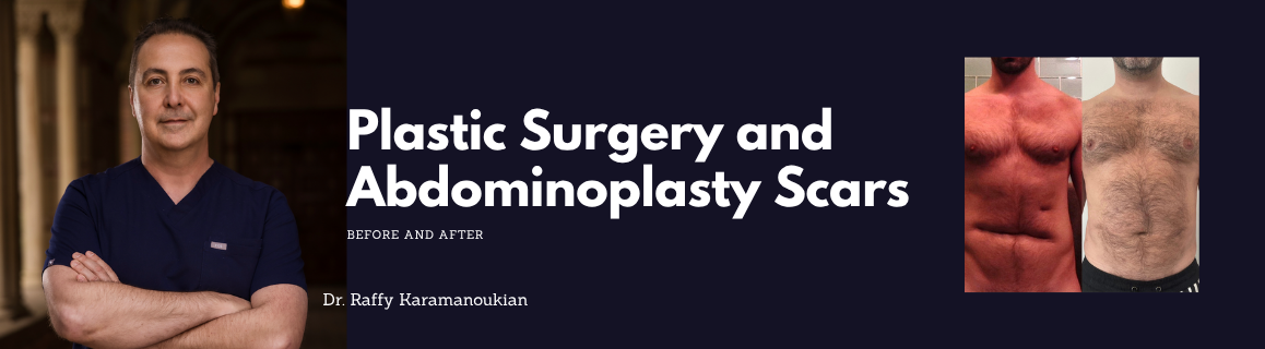 plastic surgery abdominoplasty scar revision before and after los angeles