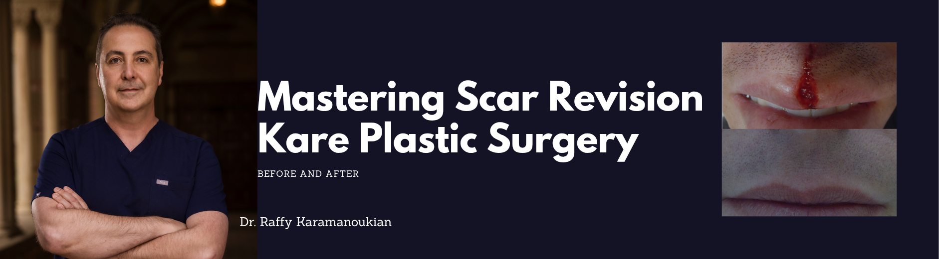 Scar Removal Doctor in Los Angeles and Beverly Hills
